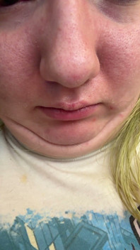 Chin Faces