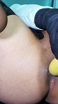 Pembesaran dubur menggunakan pakaian yang besar dan seksi