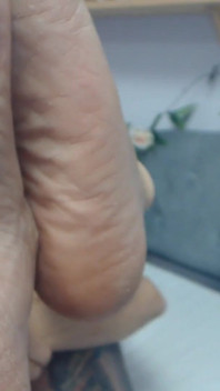 นับถือเท้าและนิ้วเท้าที่แห้งมากของฉัน