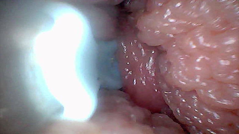 Ladybottox: Panduan Visual untuk Perspektif Endoscop Stimulasi dan Orgasme G-spot
