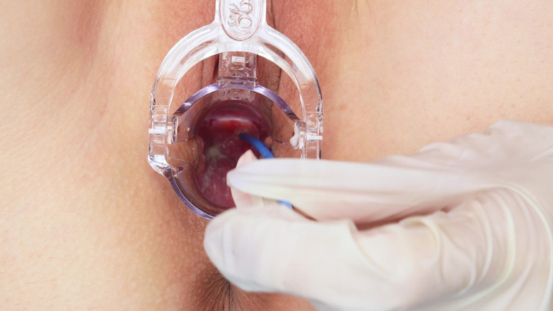 Eva Deva: Děloha/děložní hrdlo, podívej, jak jsem uvnitř! Extrémní detail