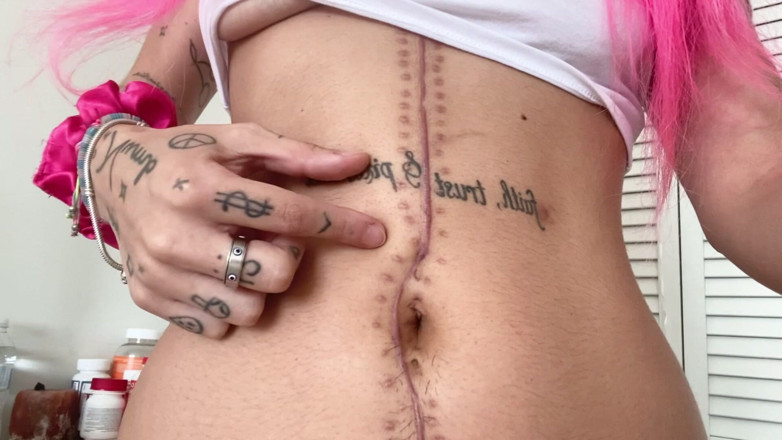 Nali Marie: Scar Fetish Belly Button Fingering Belly Worship Tummy Waist Rubbing...