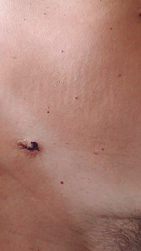My Body