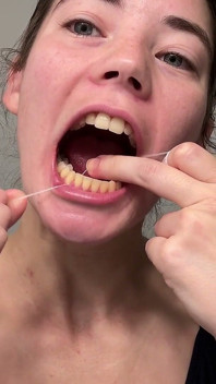 Flossing Teeth with Oral B Glide Dental Floss