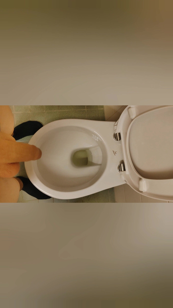 Bayer911: Golden Shower