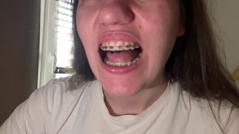 NicoleRay: 用舌头舔牙套