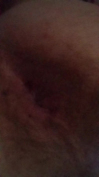 Pulse Ass