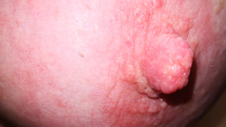 Bouncy Tits Action: Nipple squeezing in a vice