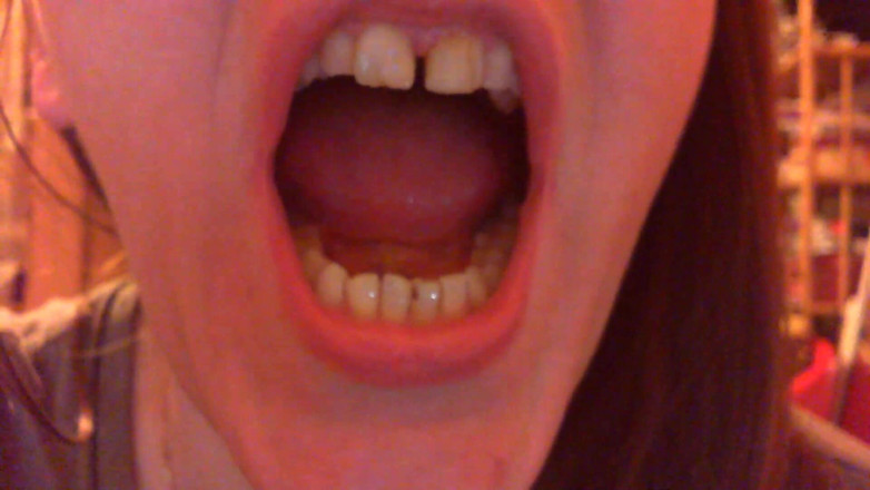 Nicoletta Embassi: Teeth Fetish Devour