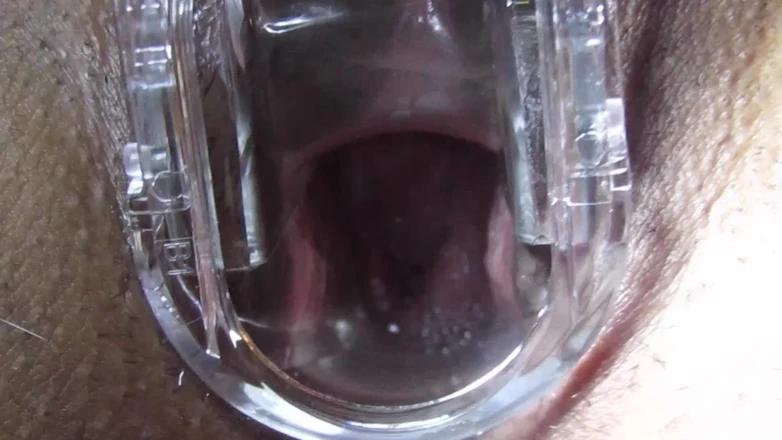VeeVee Vixen: Cum Cervix Insemination