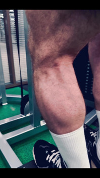 My Legs