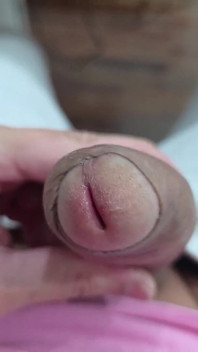 A Cabeça Do Meu Penis