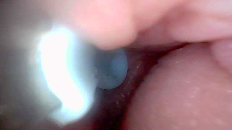 Twittiy: Diamo una sbirciatina nella mia figa succosa insieme (endoscope camera)