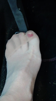 Pedalando bombeando em Birkenstocks