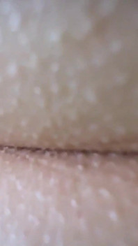 My Anal Hole Itches. if You Want, I Could Just Give You a Massage. It Will Help You