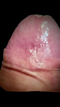 My Dick Semi Hard, Do You Want to See It Hard!?