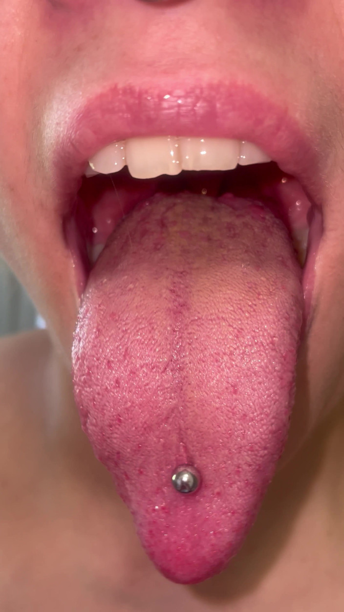 Glitterqueen1999: Mund-tour kein make-up, zähne, zunge uvula Mandeln überprüfen