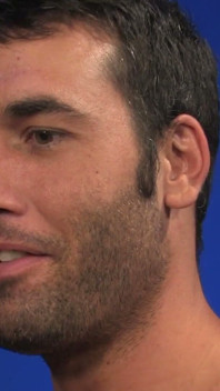 Rugburn