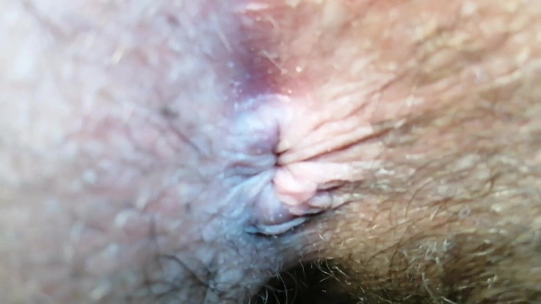 The Antichristrix: Asshole closeups compilation