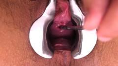 Big Speculum Stretch Makes Me Cum thumbnail
