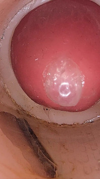 La telecamera nella figa profonda registra un enorme eiaculazione di sperma nel preservativo