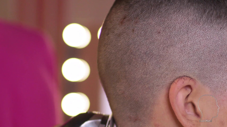 Euro Bald: Sophie