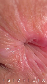 What if We Take High End Close up Camera and Shot 18 Years Old Girl Butthole Close up?