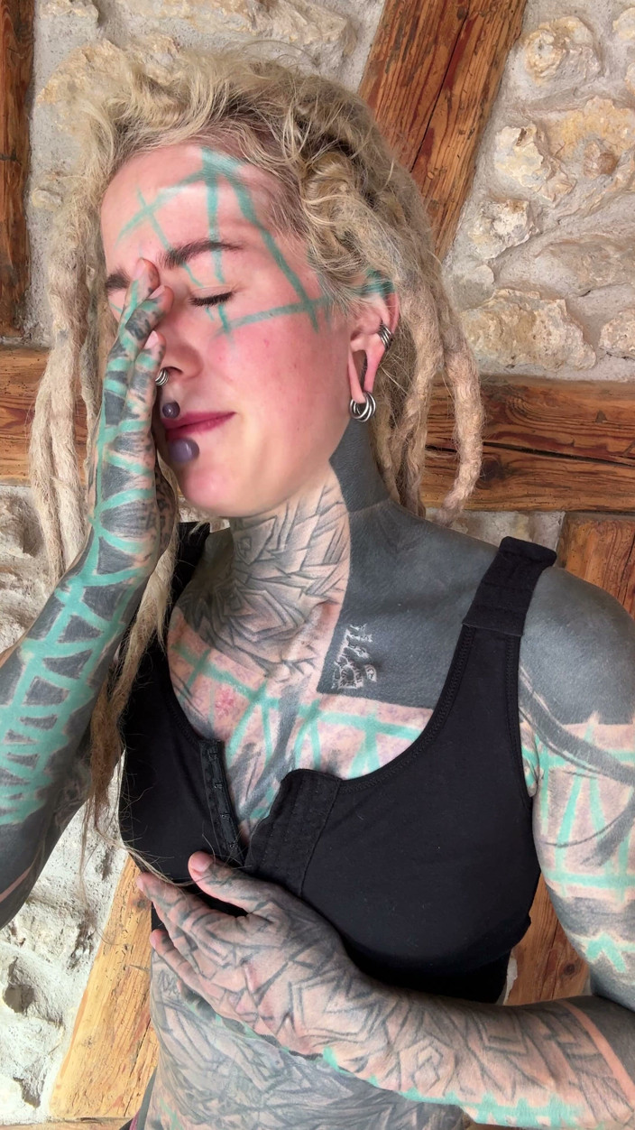 Anuskatzz: I Got New Boobs and an Upper Blephoplasty. I Will...