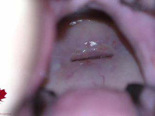 Close Up Extreme: 그녀의 자궁 경부를 공부 할 수 있도록 구멍 확장기로 여주인의 보지가 열립니다.
