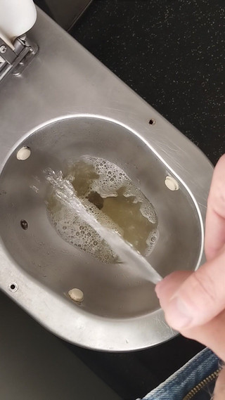 Bayer911: Bayer chcaní 2