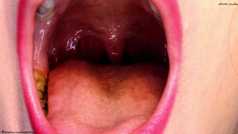 Scarlet Vixen: Khoe họng, Uvula &amp; Miệng