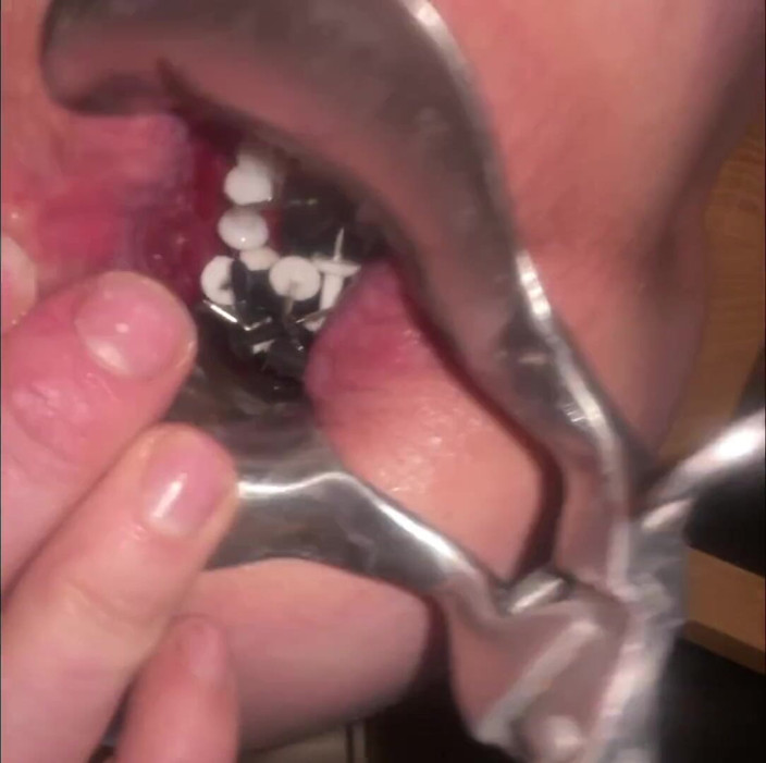 No limit cbt slave: Thumtacks hurt