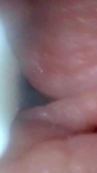 Kamera Endoskopi Menunjukkan Bagian Paling Sensitif dari Video Pendidikan Penis
