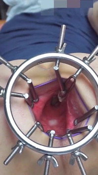 Mega Anal Spread and Deep View Into My Asshole