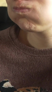 Sneezing Fit in the Car My Plastic Flower Allergy Reaction