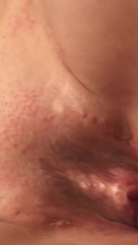 Post op trans, freak seks 3340 4-2