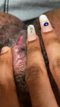 โชว์หี