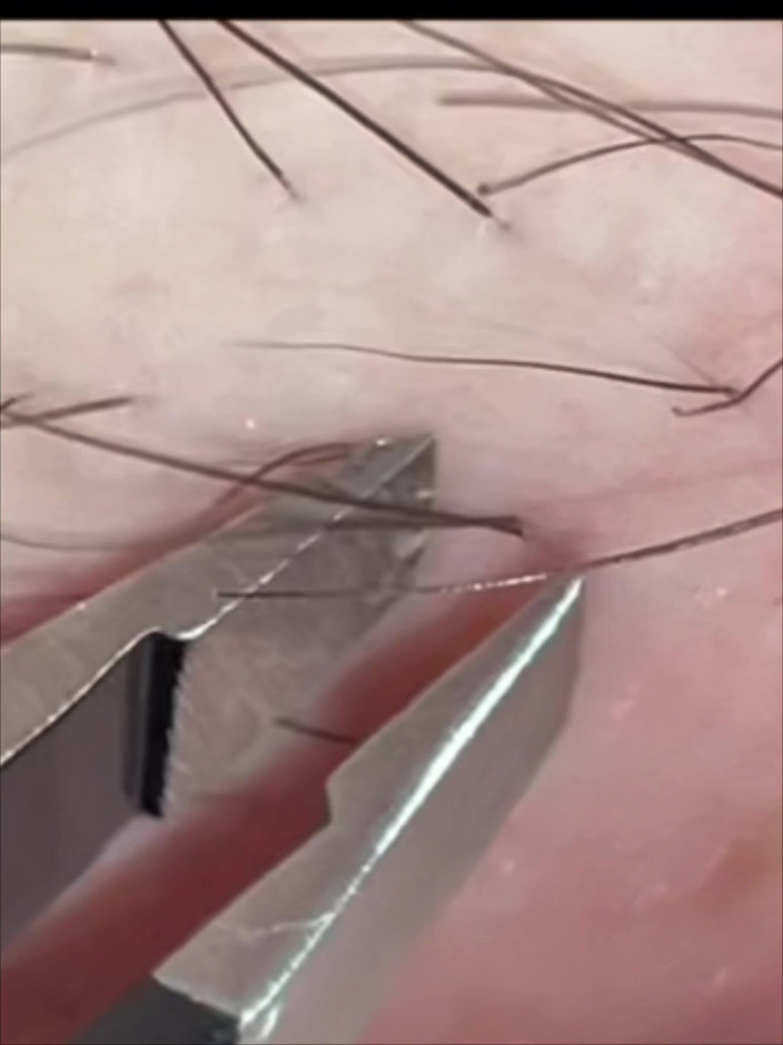 SatisfyingDillyDally: 상세 부드러움에 대한 힌트