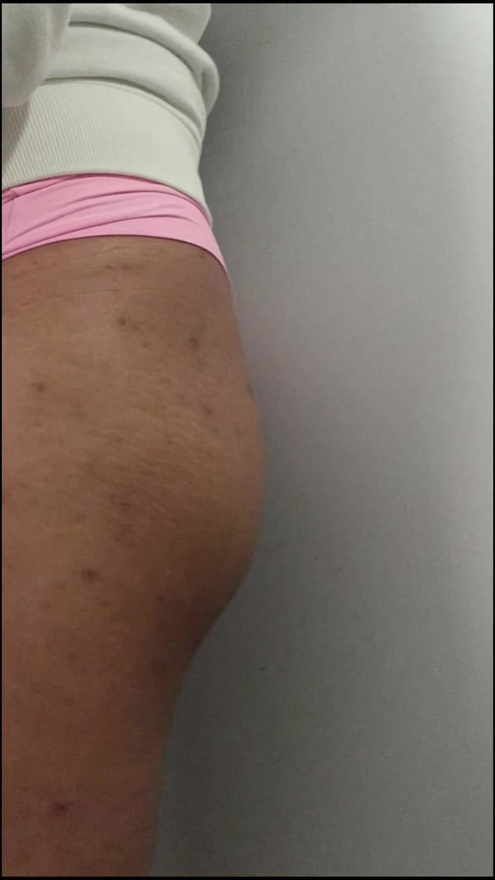 Thipansex: Când antrenamentul pentru a deveni femeie începe să dea roade