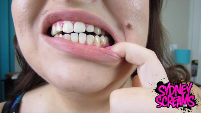 Sydney screams fetish: Post Dentist Mouth Tour - Sd