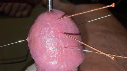 Qualzucht: Acupuncture - Orgasm!