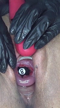 Control de cuello uterino