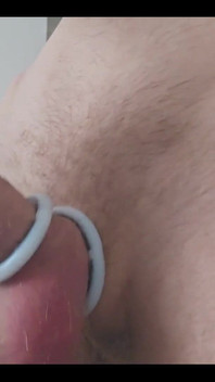 Electro Cock Shock Experiment