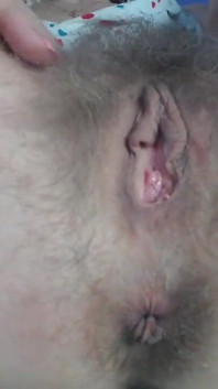 Prolapse Play Close up