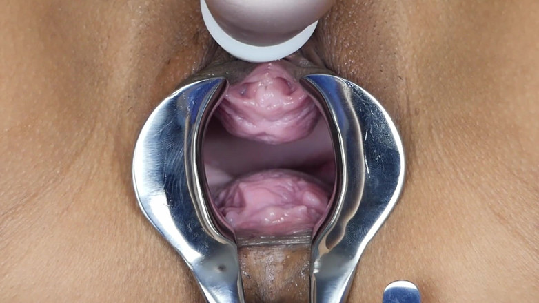 SexyThai1987: Speculum - 私の内側を深く見てください