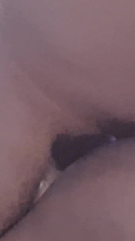 클로즈업 애널
