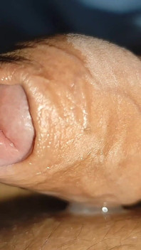 Stepdaddy Opens His Phimosis and Gets a Big Load.