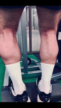 My Legs