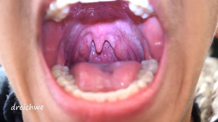 Dreichwe: Uvula fetish mouth