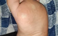 Home Pedicure with Scholl Asmr Electric File